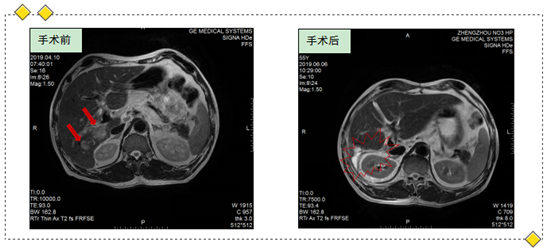 https://www.hnjkw.com/upload/localpc/xinwen/202005080924367615842.png