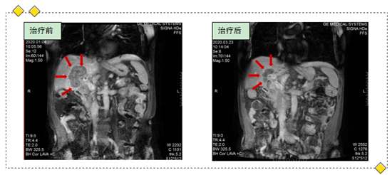 https://www.hnjkw.com/upload/localpc/xinwen/202005080924368236999.png